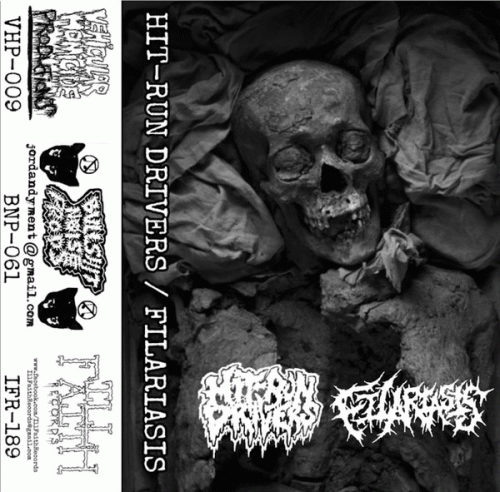 Hit-Run Drivers : Hit- Run Drivers - Filariasis Hit-Run Drivers : Hit- Run Drivers - Filariasis